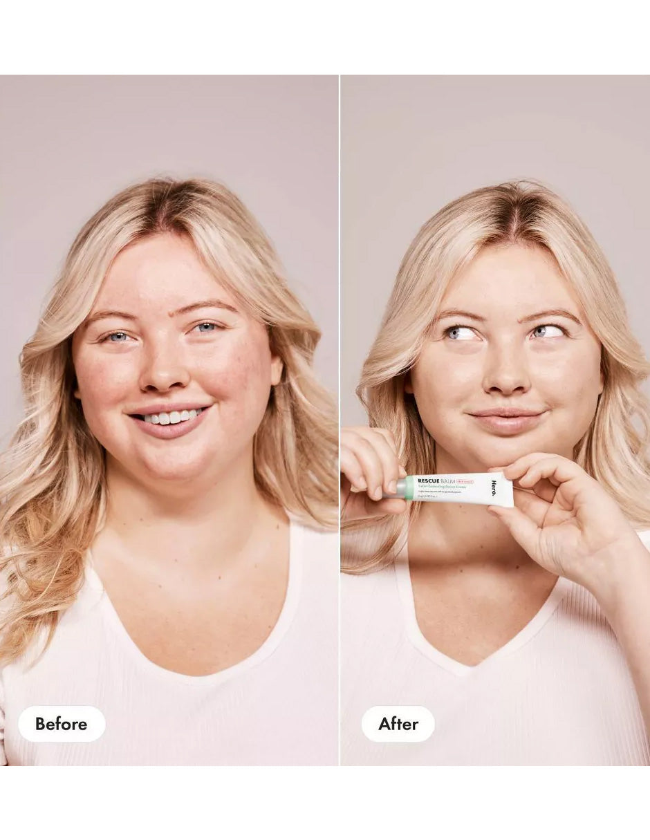 Hero Cosmetics Rescue Balm Bálsamo con color verde - Red Correct 15 ml