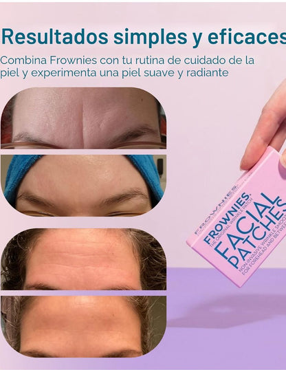 Parches Faciales Frownies para Frente 144 Piezas
