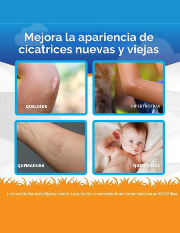 Gel para Cicatrices ScarAway Infantil Silicona 6gr