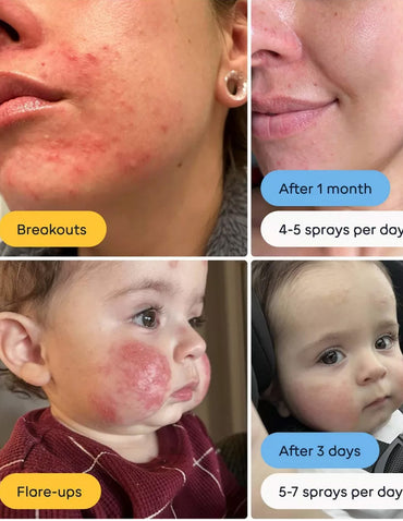 Spray para la Piel con Ácido Hipocloroso Magic Molecule 236ml