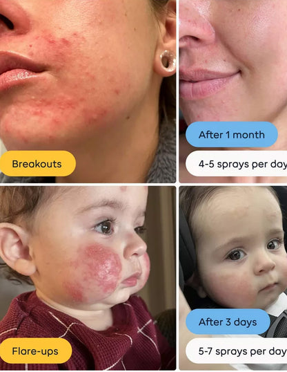 Spray para la Piel con Ácido Hipocloroso Magic Molecule 236ml