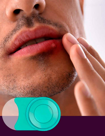 Mederma Parche curativo discreto para herpes labial, protección de 12 horas, 15 unidades