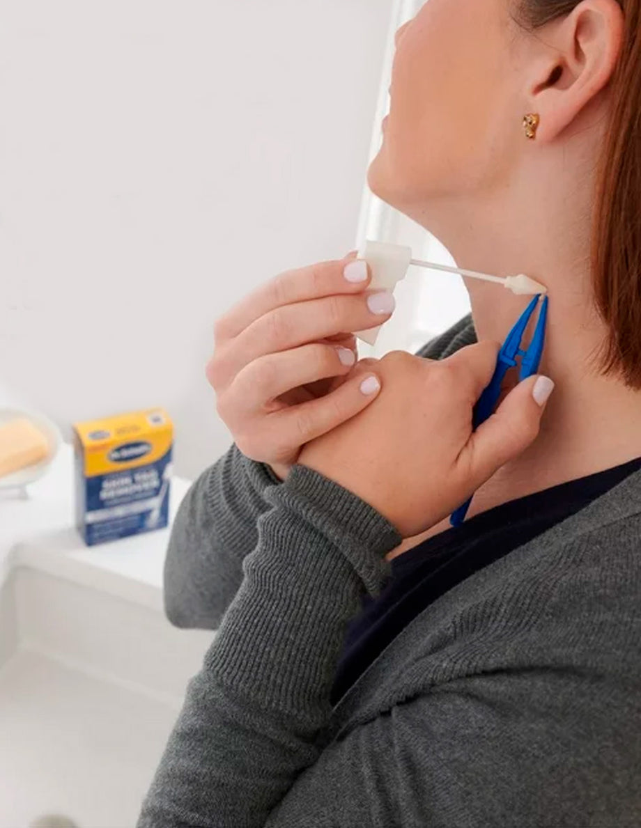 Removing Skin Tags Made Easy with Dr. Scholl's 1 Dr. Scholl's Freeze Away Skin Tag Remover, 8 unidades: elimina las mar – Dulce Alcance